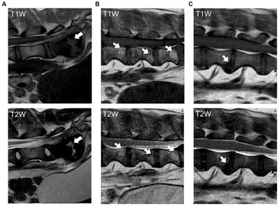 Modic changes in the lumbar vertebral column of chondrodystrophic and non-chondrodystrophic dogs with intervertebral disc disease